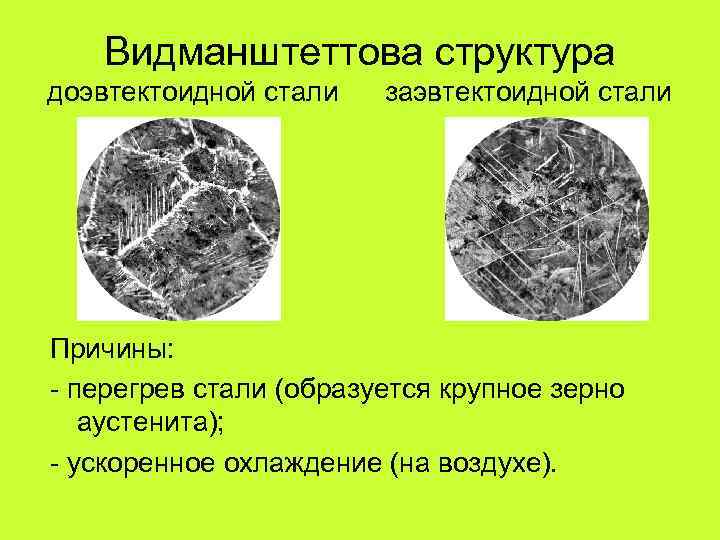 Видманштеттова структура доэвтектоидной стали заэвтектоидной стали Причины: - перегрев стали (образуется крупное зерно аустенита);