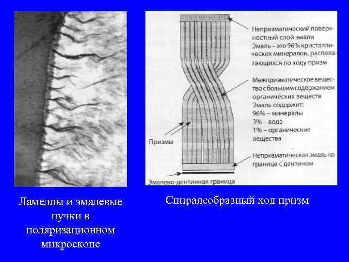 Ламеллы и эмалевые пучки в поляризационном микроскопе Спиралеобразный ход призм 
