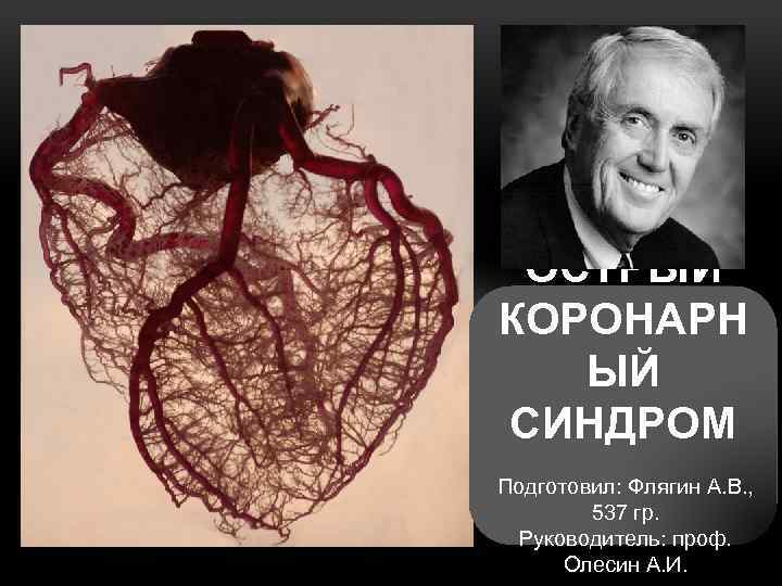 ОСТРЫЙ КОРОНАРН ЫЙ СИНДРОМ Подготовил: Флягин А. В. , 537 гр. Руководитель: проф. Олесин