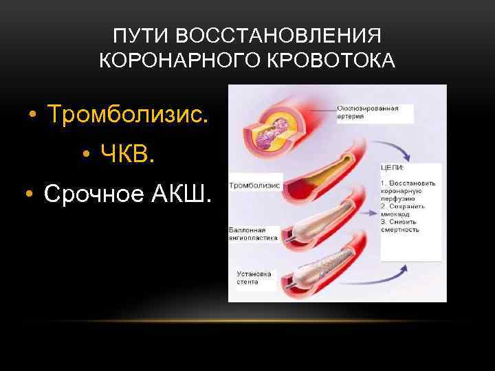ПУТИ ВОССТАНОВЛЕНИЯ КОРОНАРНОГО КРОВОТОКА • Тромболизис. • ЧКВ. • Срочное АКШ. 