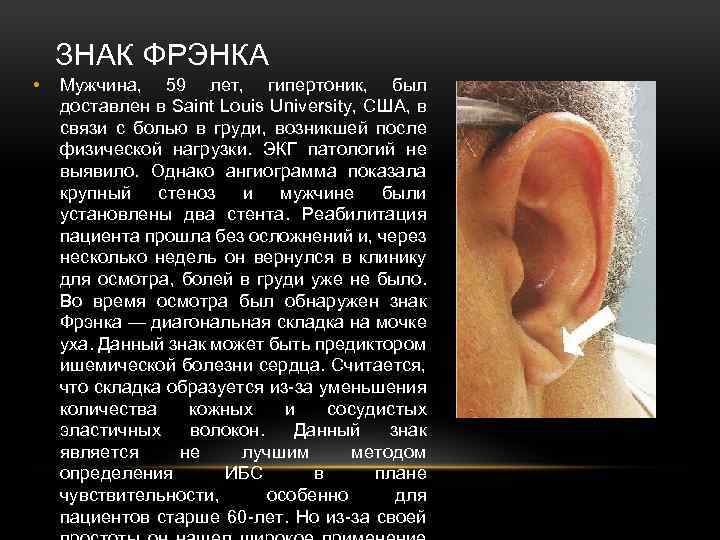 ЗНАК ФРЭНКА • Мужчина, 59 лет, гипертоник, был доставлен в Saint Louis University, США,
