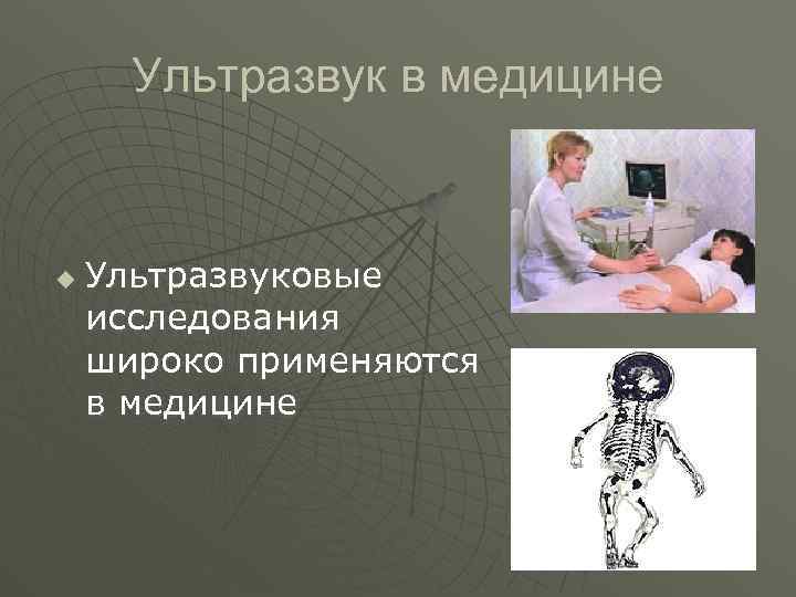 Ультразвук в медицине u Ультразвуковые исследования широко применяются в медицине 