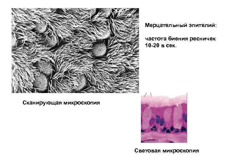 Мерцательный эпителий: частота биения ресничек 10 -20 в сек. Сканирующая микроскопия Световая микроскопия 