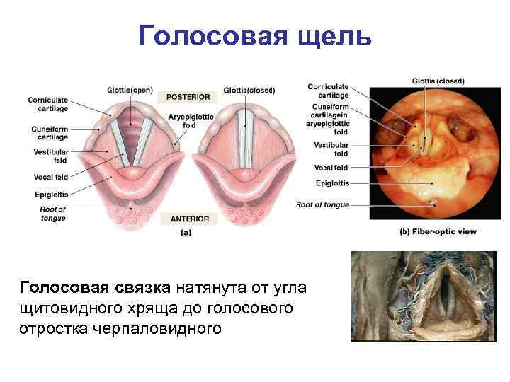 Голосовая щель Голосовая связка натянута от угла щитовидного хряща до голосового отростка черпаловидного 