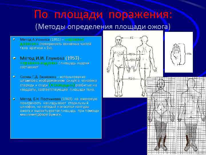 По площади поражения: (Методы определения площади ожога) Метод А. Уоллеса (1951) – «правило девяток»