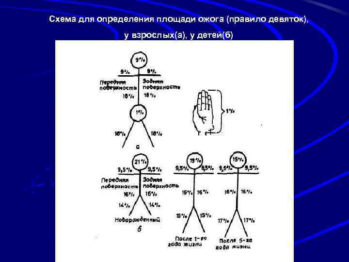 Схема для определения площади ожога (правило девяток), у взрослых(а), у детей(б) 