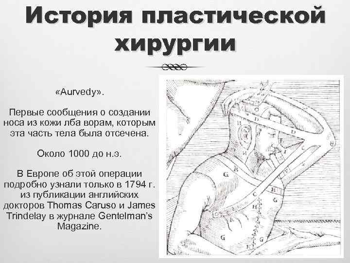 История пластической хирургии «Aurvedy» . Первые сообщения о создании носа из кожи лба ворам,