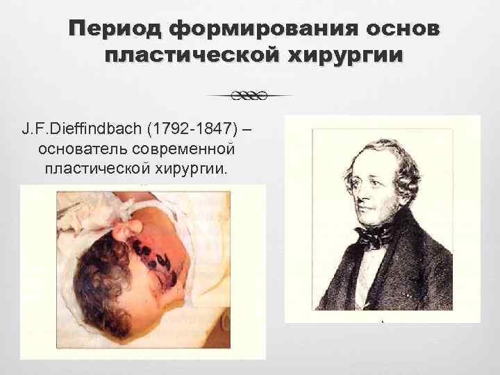 Период формирования основ пластической хирургии J. F. Dieffindbach (1792 -1847) – основатель современной пластической