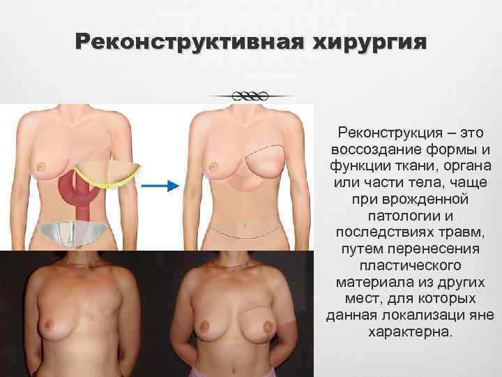 Реконструктивная хирургия Реконструкция – это воссоздание формы и функции ткани, органа или части тела,