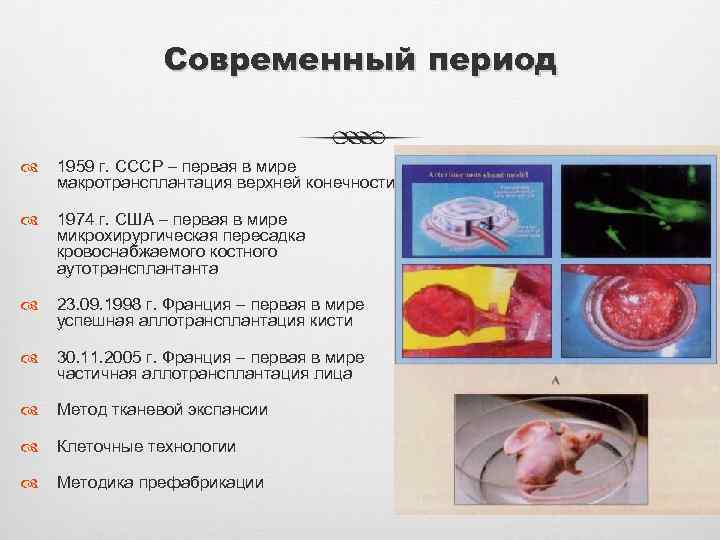 Современный период 1959 г. СССР – первая в мире макротрансплантация верхней конечности 1974 г.