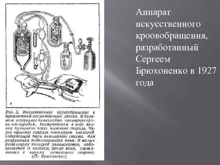 Аппарат искусственного кроовобращения, разработанный Сергеем Брюхоненко в 1927 года 
