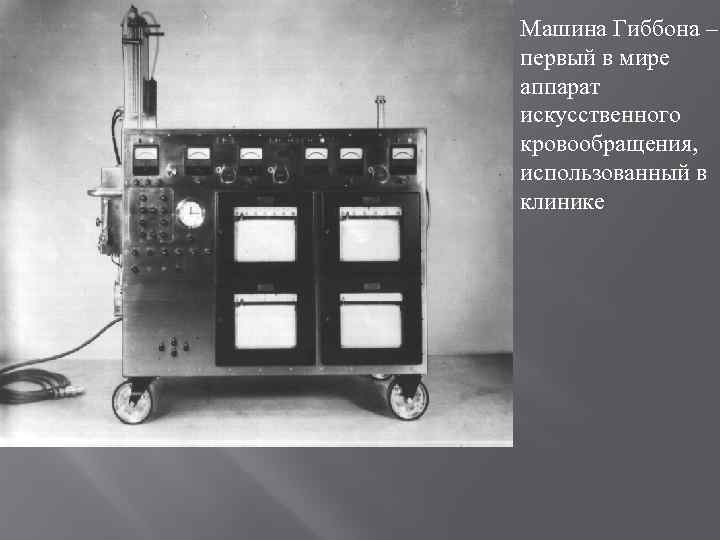 Первый аппарат в мире. Джон Гиббон аппарат искусственного кровообращения. Аппарат искусственного кровообращения Брюхоненко. АИК аппарат искусственного. Аппарат искусственного кровообращения, 1926.
