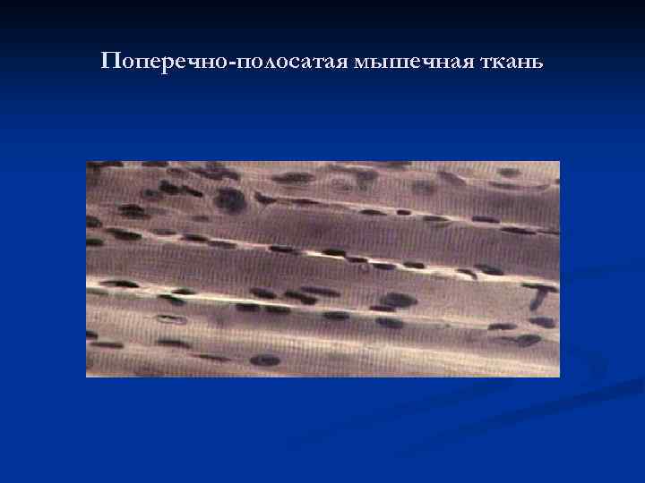 Поперечно-полосатая мышечная ткань 