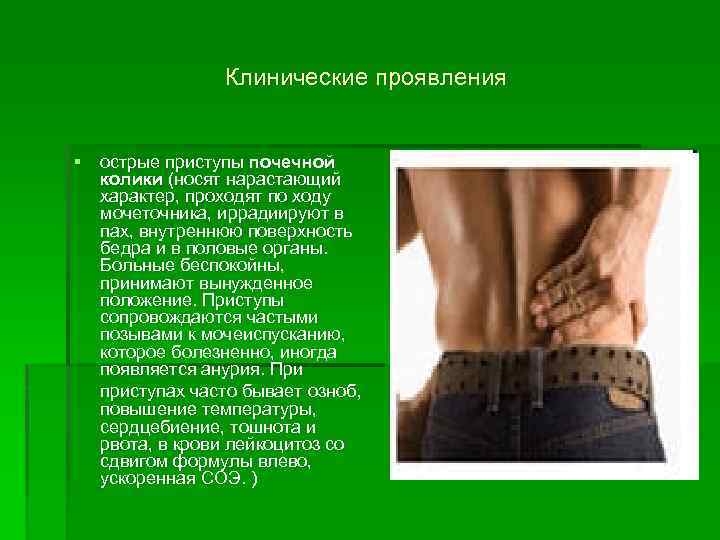 Клинические проявления § острые приступы почечной колики (носят нарастающий характер, проходят по ходу мочеточника,