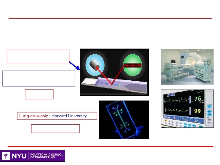 Lung-on-a-chip : Harvard University 