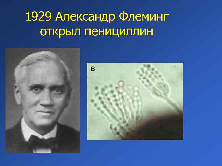 1929 Александр Флеминг открыл пенициллин 