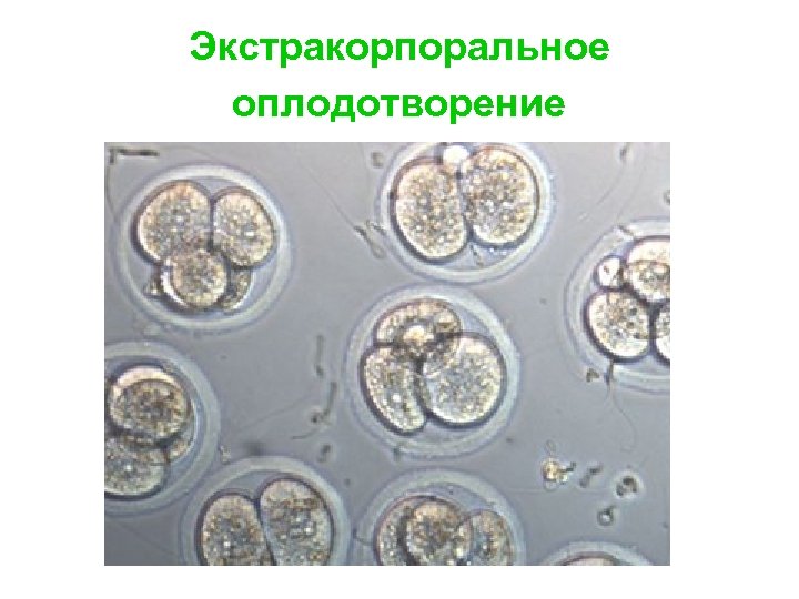 Экстракорпоральное оплодотворение 