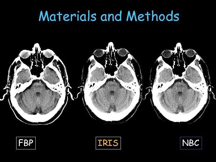 Materials and Methods FBP IRIS NBC 