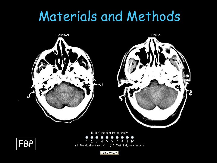 Materials and Methods FBP 