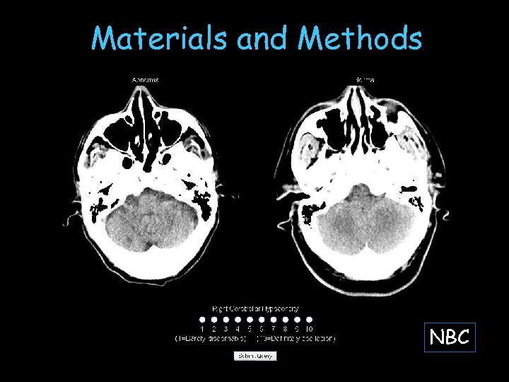 Materials and Methods NBC 