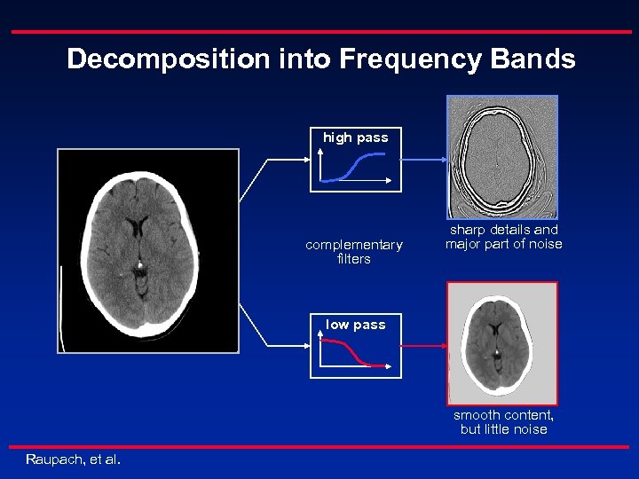Decomposition into Frequency Bands high pass complementary filters sharp details and major part of
