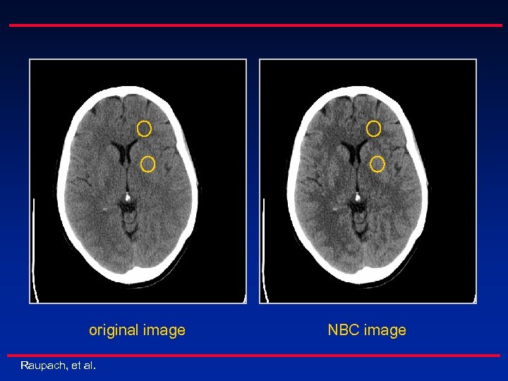 original image Raupach, et al. NBC image 
