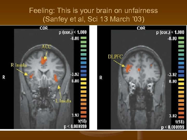 Feeling: This is your brain on unfairness (Sanfey et al, Sci 13 March ’