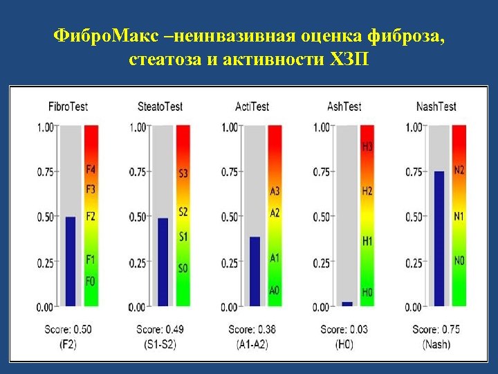 Фибро. Макс –неинвазивная оценка фиброза, стеатоза и активности ХЗП 