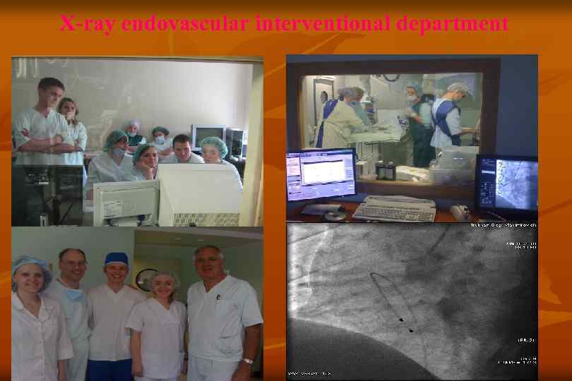 X-ray endovascular interventional department 