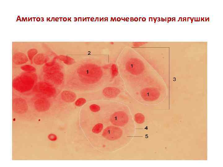 Ключевые клетки в мазке фото