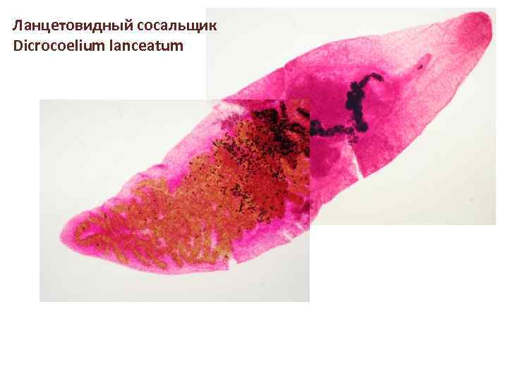 Ланцетовидный сосальщик Dicrocoelium lanceatum 