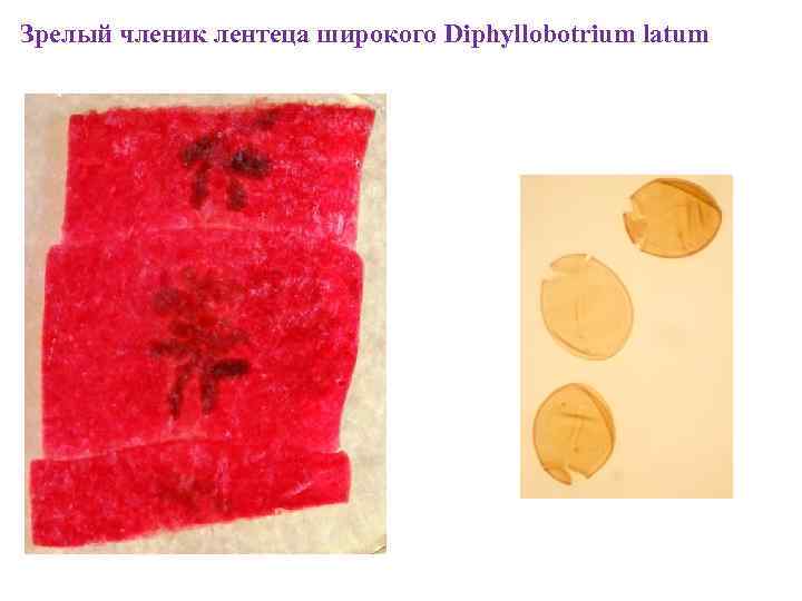 Зрелый членик лентеца широкого Diphyllobotrium latum 