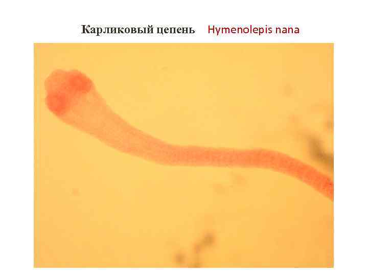 Карликовый цепень Hymenolepis nana 