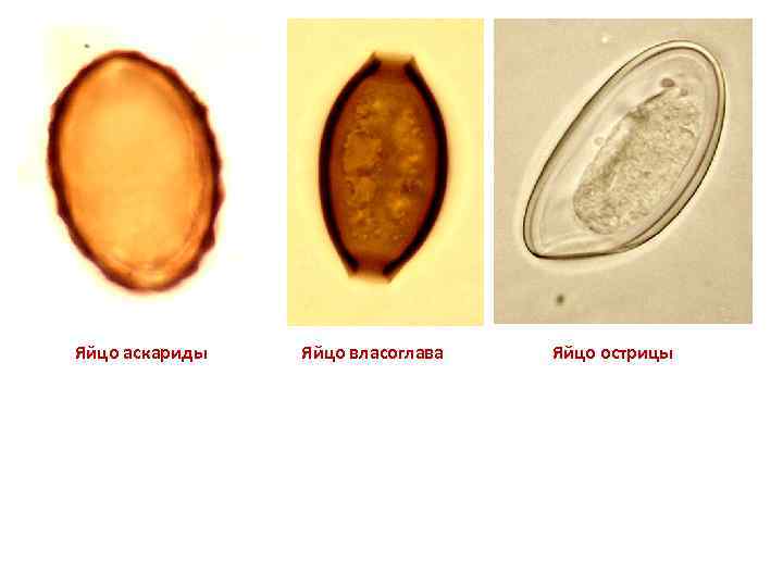 Рисунок яйца аскариды