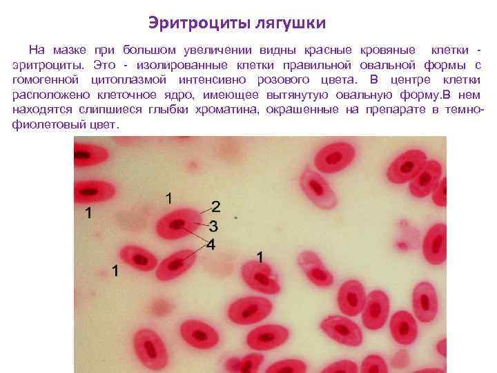 Ключевые клетки в мазке фото