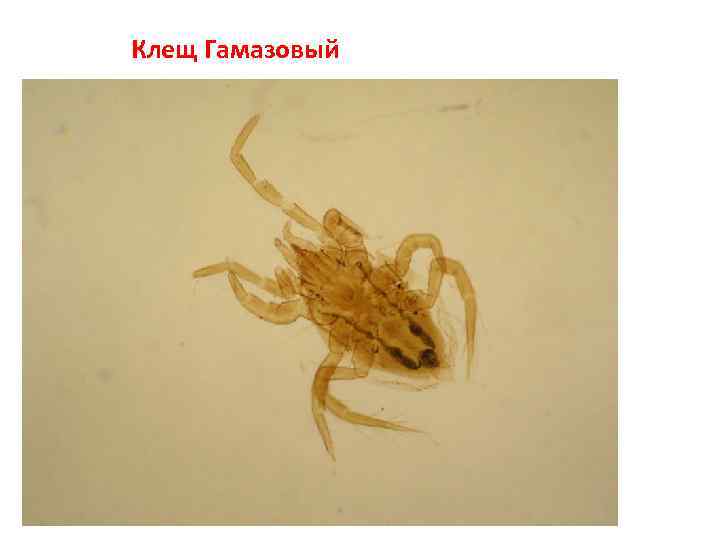 Клещ Гамазовый 