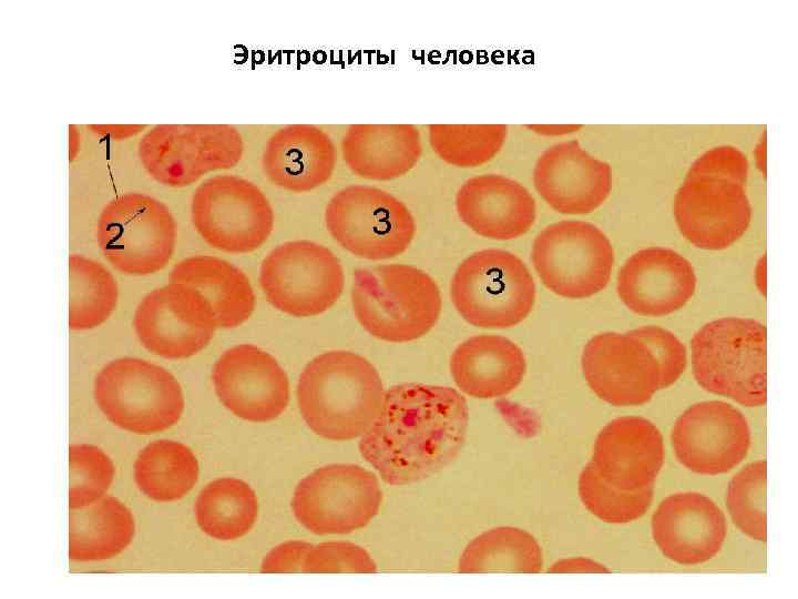 Укажите какой цифрой на рисунке обозначены эритроциты лягушки а какой эритроциты человека