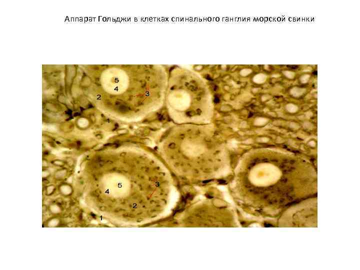 Аппарат Гольджи в клетках спинального ганглия морской свинки 