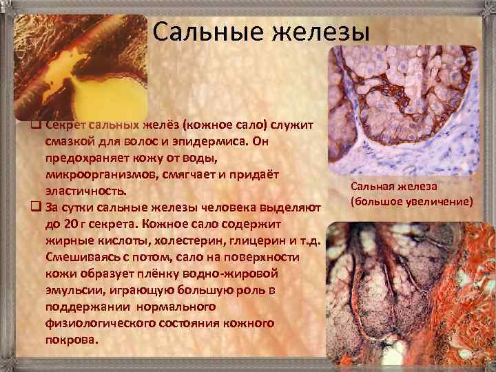 Сальные железы q Секрет сальных желёз (кожное сало) служит смазкой для волос и