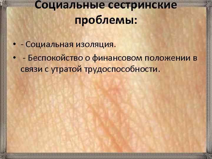 Социальные сестринские проблемы: • - Социальная изоляция. • - Беспокойство о финансовом положении в