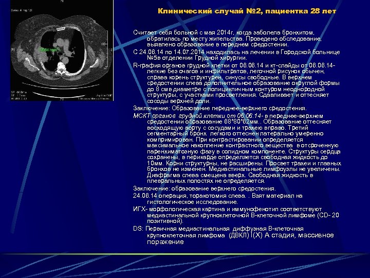 Клинический случай № 2, пациентка 28 лет Считает себя больной с мая 2014 г,