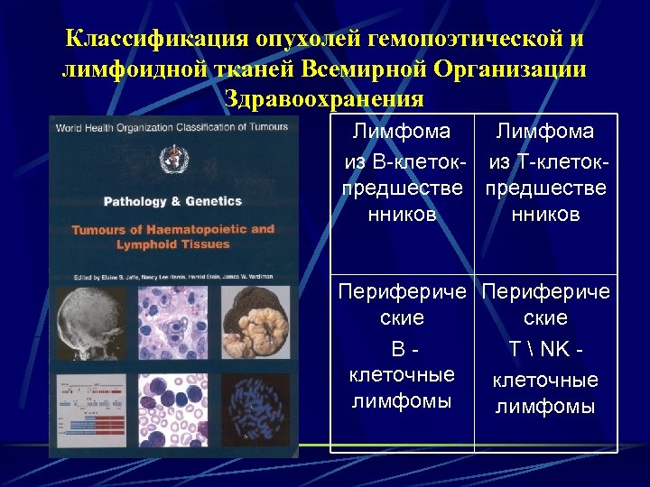 Классификация опухолей гемопоэтической и лимфоидной тканей Всемирной Организации Здравоохранения Лимфома из В-клеток- из Т-клетокпредшестве
