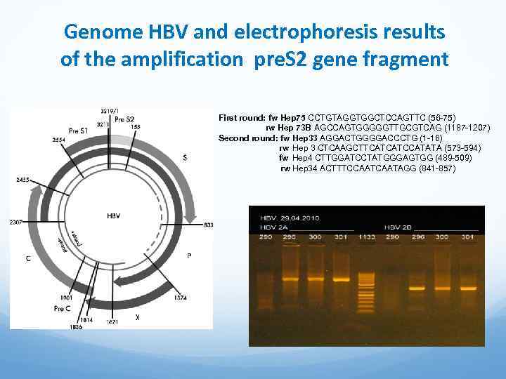 Genome HBV and electrophoresis results of the amplification pre. S 2 gene fragment First
