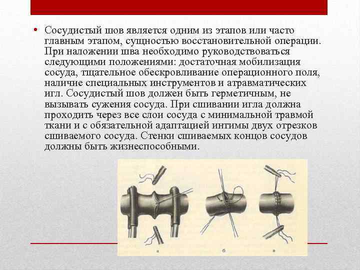 Сосудистый шов методы наложения