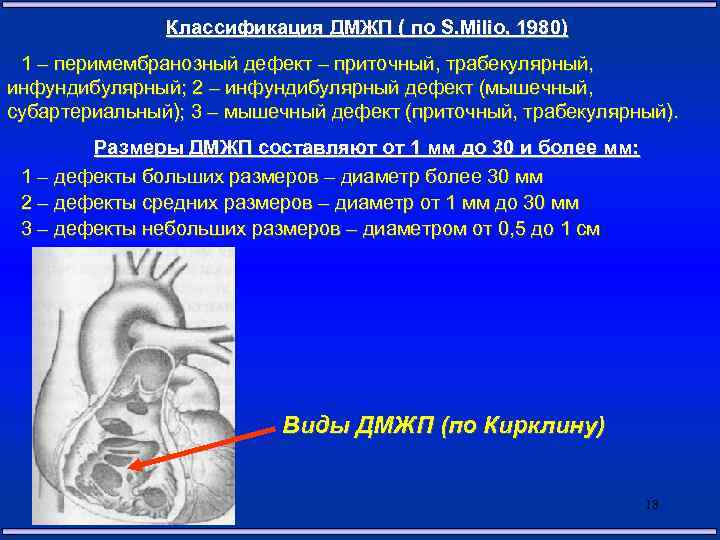 Классификация ДМЖП ( по S. Milio, 1980) 1 – перимембранозный дефект – приточный, трабекулярный,