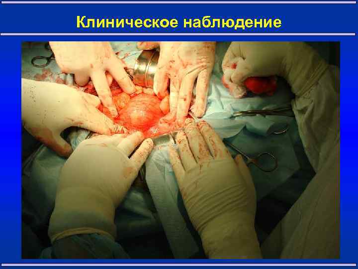 Клиническое наблюдение 20 