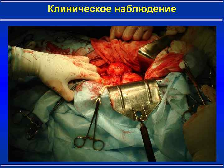 Клиническое наблюдение 21 