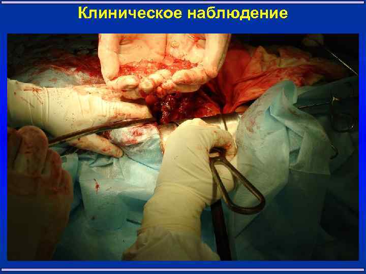 Клиническое наблюдение 22 