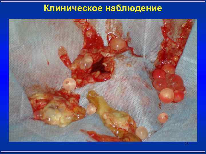 Клиническое наблюдение 23 