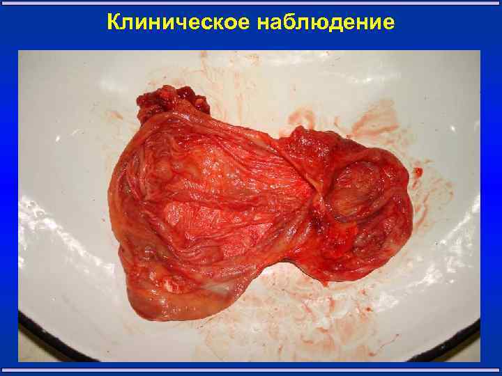 Клиническое наблюдение 24 